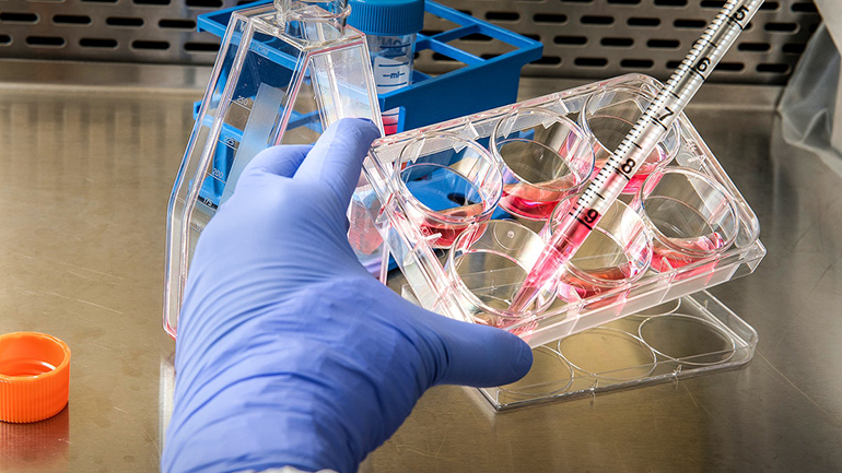 Επιβεβαιώθηκε το πρώτο κρούσμα ευλογιάς των πιθήκων στην Αυστρία