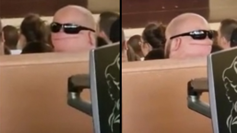 Όταν το πίσω μέρος του κεφαλιού σου «χαμογελάει»