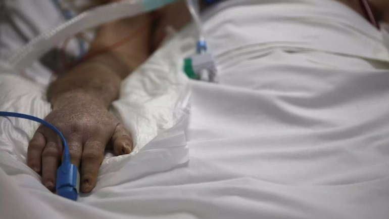 ΕΟΔΥ για λέπρα: Ιάσιμη νόσος και όχι πολύ μεταδοτική