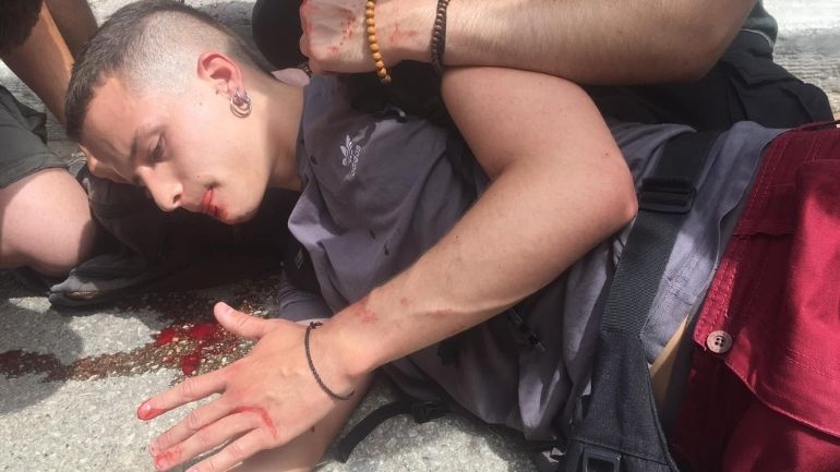 Θεσσαλονίκη: Ένας αστυνομικός κι ένας φοιτητής στο νοσοκομείο από τα επεισόδια στο ΑΠΘ Θεσσαλονίκη: Ένας αστυνομικός κι ένας φοιτητής στο νοσοκομείο από τα επεισόδια στο ΑΠΘ