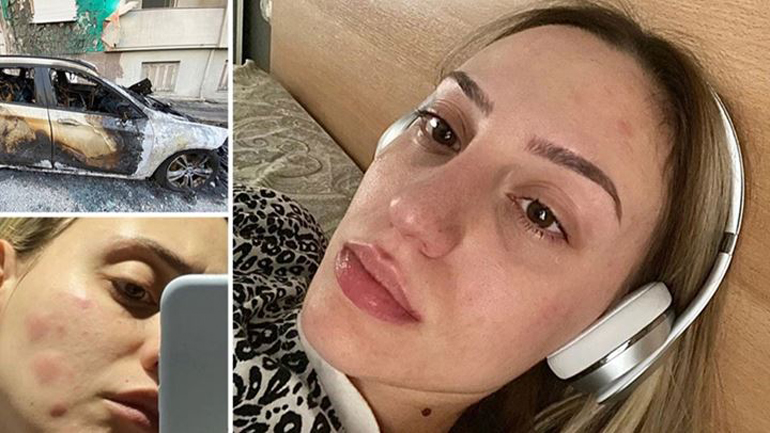 Άννα Κορακάκη: Περιγράφει τα όσα βίωσε με τον εμμονικό θαυμαστή της με μια σειρά από φωτογραφίες