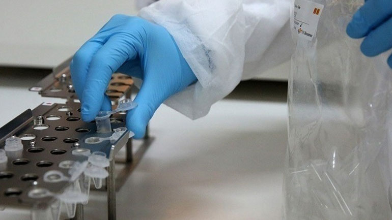 Ισημερινός: Εντοπίστηκε το πρώτο «ύποπτο» κρούσμα ευλογιάς των πιθήκων