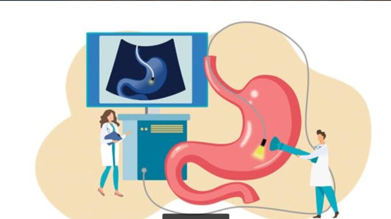 Οριστική λύση στην αχαλασία οισοφάγου και το εκκόλπωμα Zenker  