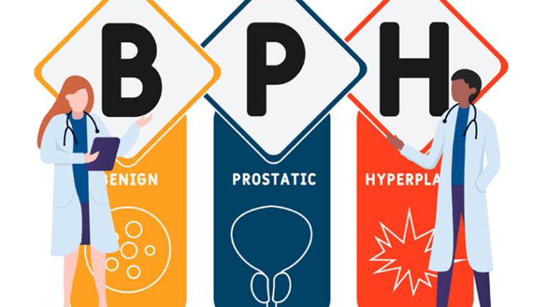 Μέθοδος Rezum: Νέα εποχή στην αντιμετώπιση της καλοήθους υπερπλασίας του προστάτη