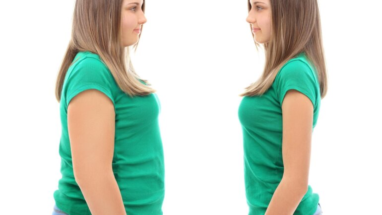 Φάρμακο για τον διαβήτη είναι εξαιρετικά αποτελεσματικό στη μείωση της παχυσαρκίας