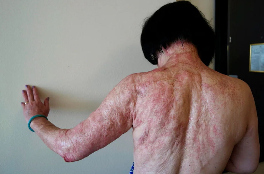 Μια φωτογραφία που τραβήχτηκε το 2015 για να θυμίζει πάντα την φρίκη του πολέμου