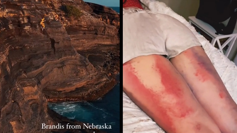 Κακή ιδέα η βουτιά στο νερό από ένα γκρεμό