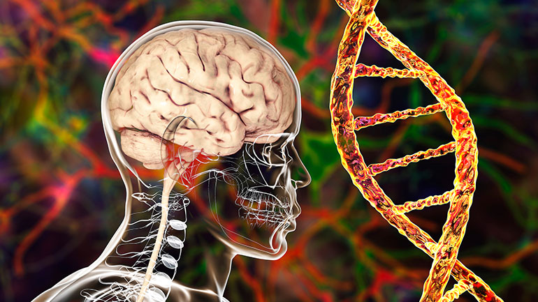 Τα «εμβόλια»-COVID συνδέονται με νέο τύπο ανίατης, θανατηφόρας εκφυλιστικής διαταραχής του εγκεφάλου