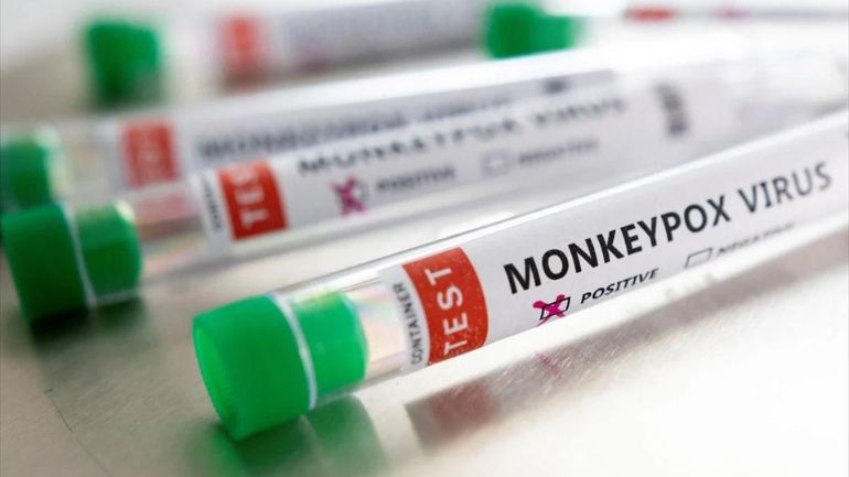 Ευλογιά των πιθήκων: Δύο περιστατικά στην Ελλάδα – Ποια είναι η κατάσταση των ασθενών Ευλογιά των πιθήκων: Δύο περιστατικά στην Ελλάδα – Ποια είναι η κατάσταση των ασθενών