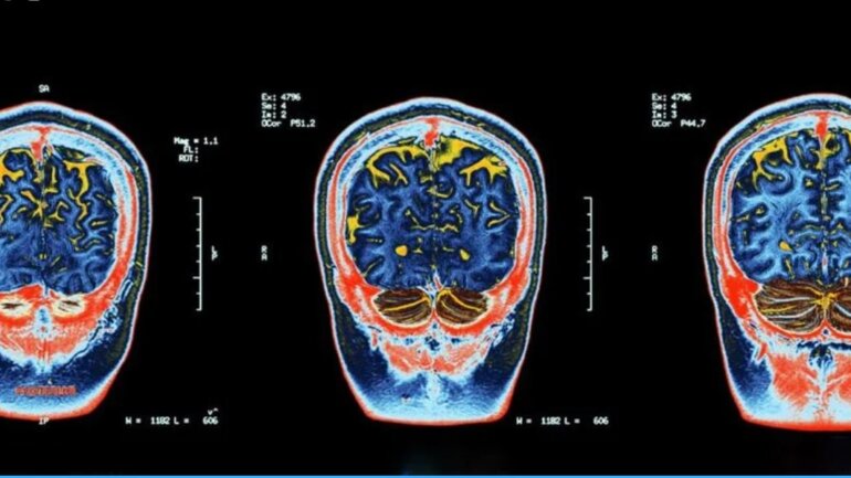 Η κοινωνική απομόνωση αλλάζει τη δομή του εγκεφάλου, αποκαλύπτει μελέτη νευροαπεικόνισης Η κοινωνική απομόνωση αλλάζει τη δομή του εγκεφάλου, αποκαλύπτει μελέτη νευροαπεικόνισης