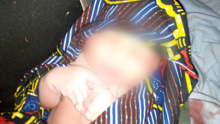 Λέσβος: Νεαρή πρόσφυγας γέννησε στη νησίδα Μπαρμπαλιάς