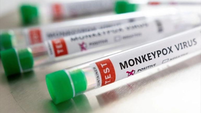 Ευλογιά των πιθήκων: Τρία τα περιστατικά στην Ελλάδα