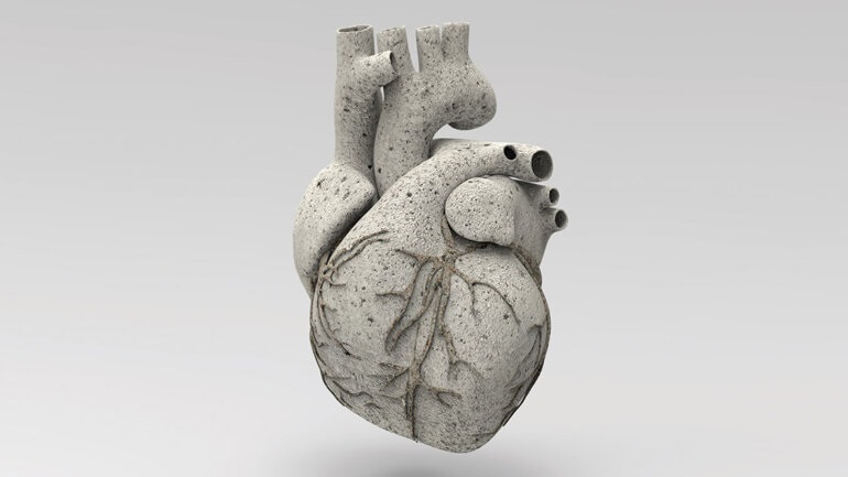 Σχολείο ασθενών με καρδιαγγειακές παθήσεις