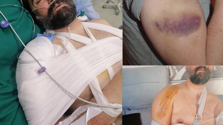 «Λεπτή η γραμμή ανάμεσα στη ζωή και στον θάνατο» – Σοκάρει ο διασώστης του ΕΚΑΒ που ξυλοκοπήθηκε άγρια στη Σαλαμίνα