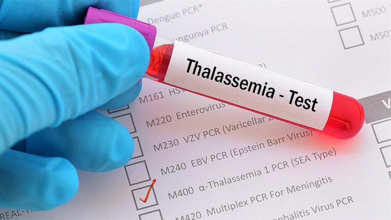 Φάκελος “Αίμα”: Κλειδί για την αντιμετώπιση των ελλείψεων η βελτιστοποίηση της διαχείρισης του αίματος 