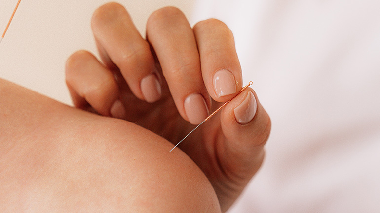 Ο βελονισμός μπορεί να μειώσει τους χρόνιους πονοκεφάλους