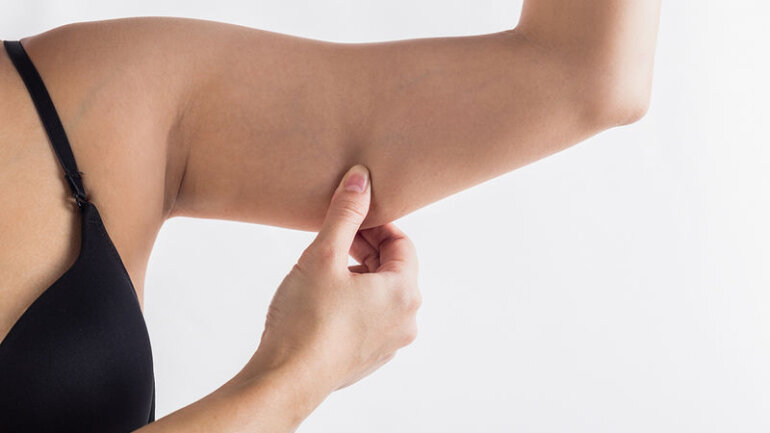 Εμμηνόπαυση: Τι συμβαίνει με τα μπράτσα σας