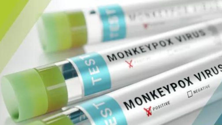 Ευλογιά των πιθήκων: 13 επιβεβαιωμένα περιστατικά στην Ελλάδα