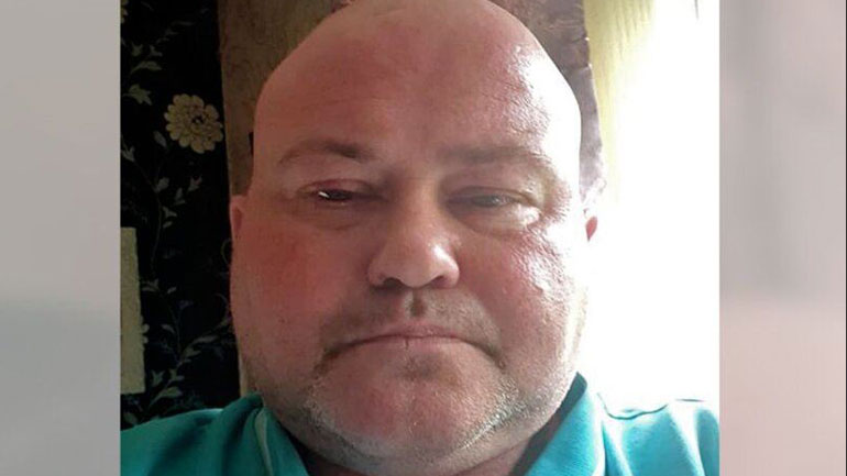 Νεκρός Βρετανός αιχμάλωτος στο Ντονέτσκ – «Πλήρης η ευθύνη της Ρωσίας» λέει η Τρας