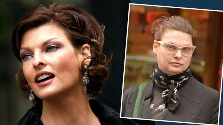 Linda Evangelista: Φωτογραφίζεται στην πρώτη της καμπάνια μετά την επέμβαση που την παραμόρφωσε