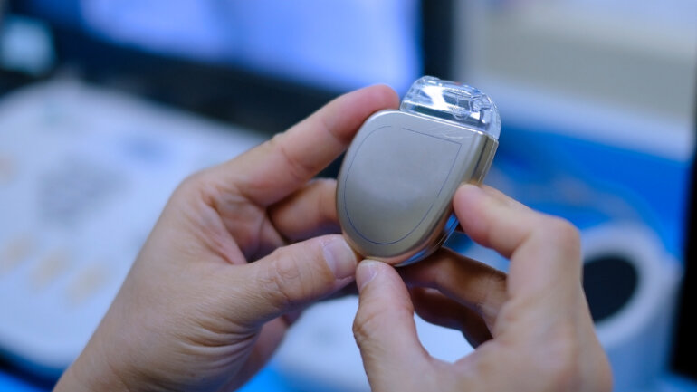 Βηματοδότης εγκεφάλου: Η «επανάσταση» στη θεραπεία της Πάρκινσον