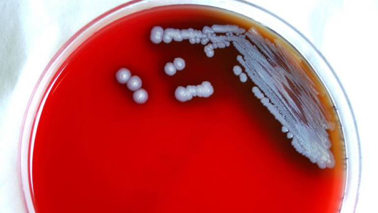 ΗΠΑ: Βακτήρια που προκαλούν σπάνια αλλά θανατηφόρα λοίμωξη εντοπίστηκαν στον Μισισιπή