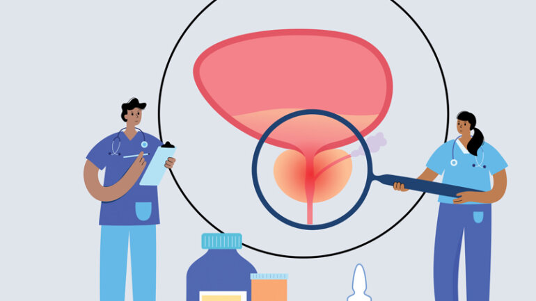 ​​​​​​​Υπερτροφία του προστάτη: Θεραπεία χωρίς χειρουργείο