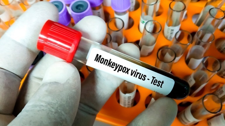 Το Tecovirimat ως θεραπεία για την ευλογιά των πιθήκων 