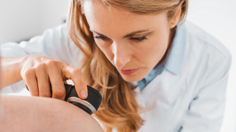 Μελάνωμα: Η καθοριστική συμμετοχή του χειρουργείου