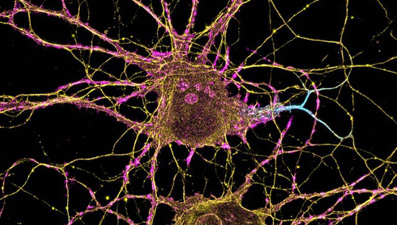 ΗΠΑ: Ανακαλύφθηκαν ειδικοί νευρώνες του φαγητού στον ανθρώπινο εγκέφαλο