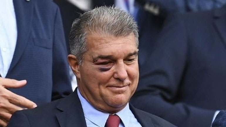 Μπαρτσελόνα: Με μαυρισμένο μάτι ο Λαπόρτα στο «Καμπ Νου»