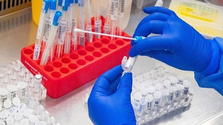 Πρώτο κρούσμα ευλογιάς των πιθήκων στην Αίγυπτο