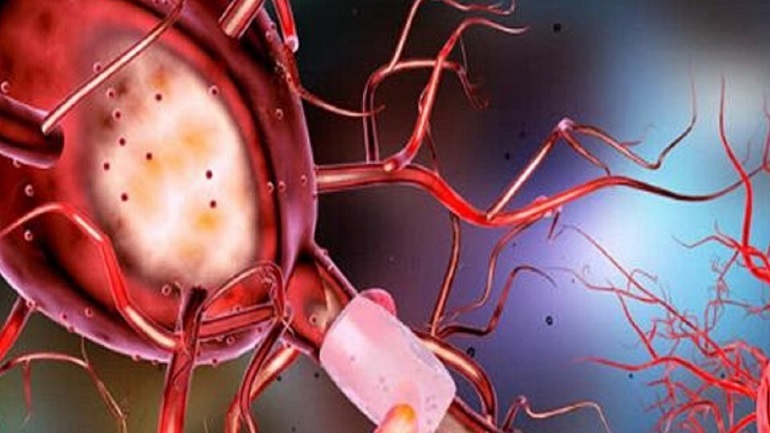 Σουηδική μελέτη: Οι συχνές σοβαρές λοιμώξεις αυξάνουν τον κίνδυνο για Αλτσχάιμερ και Πάρκινσον