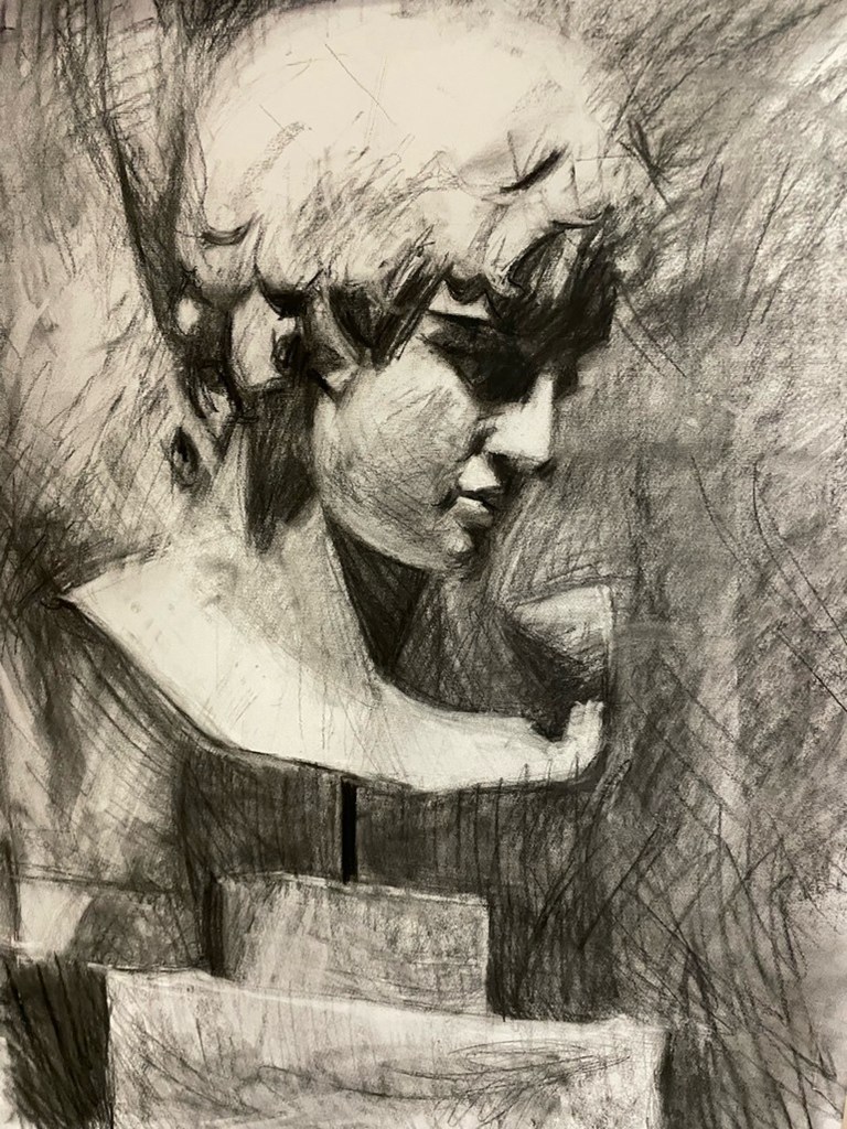 Ο υδροκέφαλος