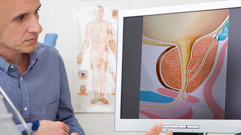 Καλοήθης Υπερπλασία Προστάτη: Σύγχρονες μέθοδοι στη χειρουργική αντιμετώπιση