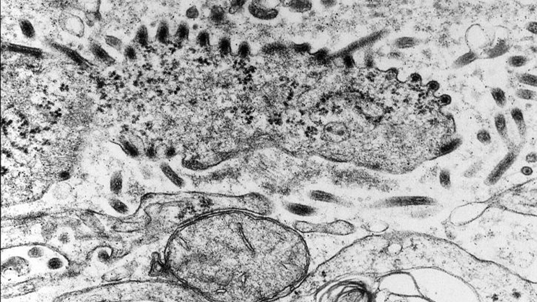 Ουγκάντα: Εννέα νέα κρούσματα Έμπολα επιβεβαιώθηκαν στην Καμπάλα