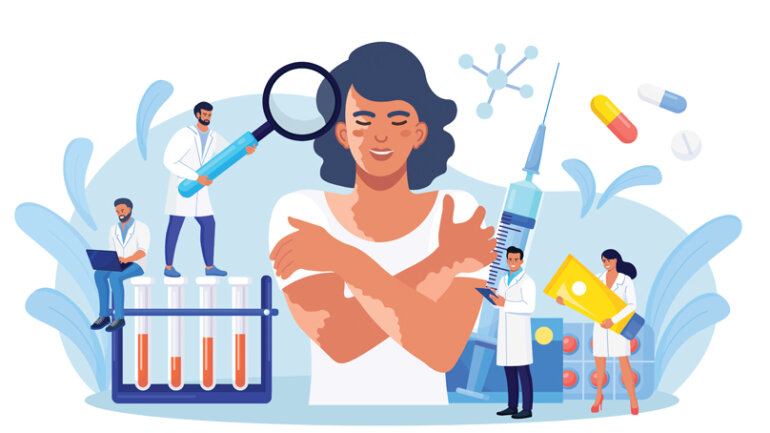 Ψωρίαση: Τύποι και θεραπείες