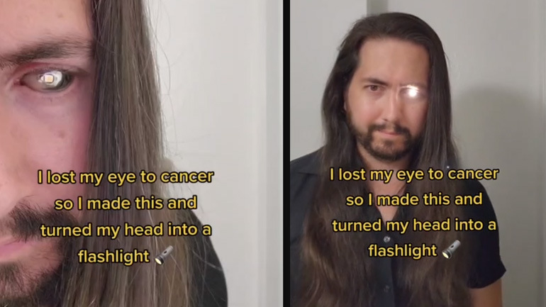 Τεχνητό μάτι με φακό