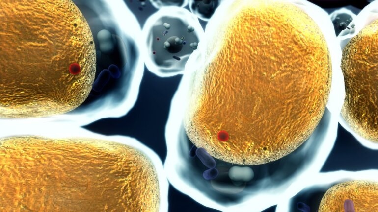 Το κοιλιακό λίπος σχετίζεται με την αρτηριακή πίεση και τα λιπίδια στο αίμα