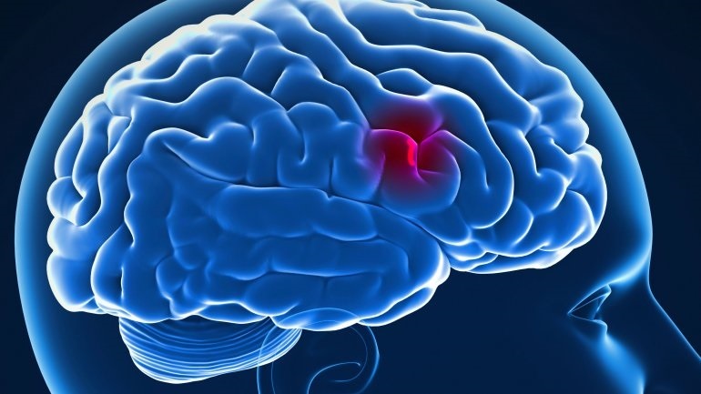 Μειωμένος κίνδυνος αγγειακού εγκεφαλικού επεισοδίου στα άτομα που εμβολιάζονται έναντι της γρίπης