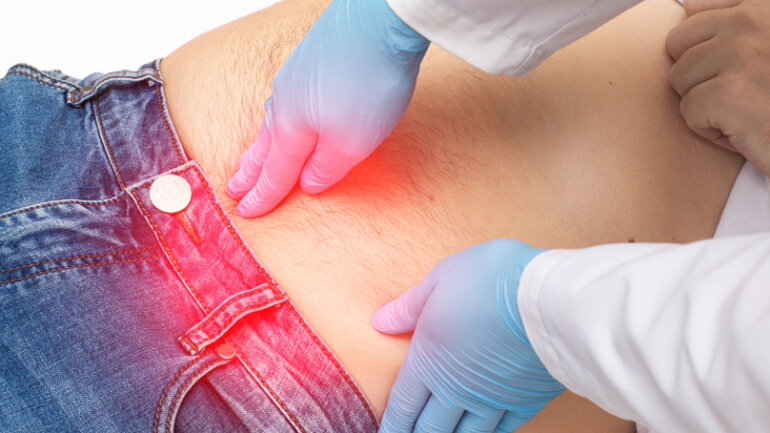 Νέα ελάχιστα επεμβατική μέθοδος για την αποκατάσταση της μετεγχειρητικής κήλης