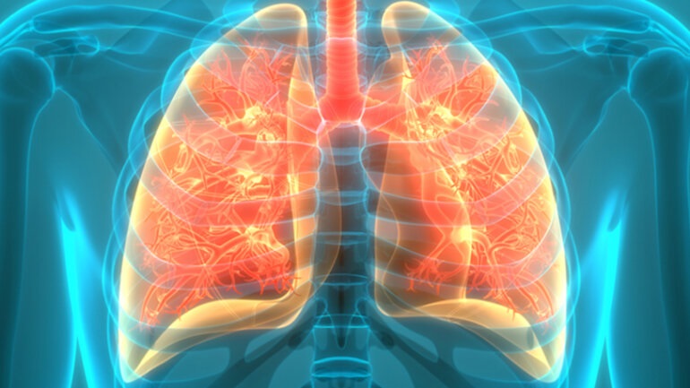 Παγκόσμια Ημέρα Χρόνιας Αποφρακτικής Πνευμονοπάθειας (ΧΑΠ) – Ο «σιωπηλός δολοφόνος» που απειλεί 1.000.000 Έλληνες Παγκόσμια Ημέρα Χρόνιας Αποφρακτικής Πνευμονοπάθειας (ΧΑΠ) – Ο «σιωπηλός δολοφόνος» που απειλεί 1.000.000 Έλληνες