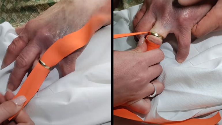 Αφαίρεση δαχτυλιδιού κολλημένο σε δάχτυλο