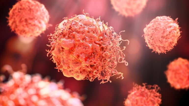 Η διατροφική αλλαγή που κάνει τα καρκινικά κύτταρα να λιμοκτονούν