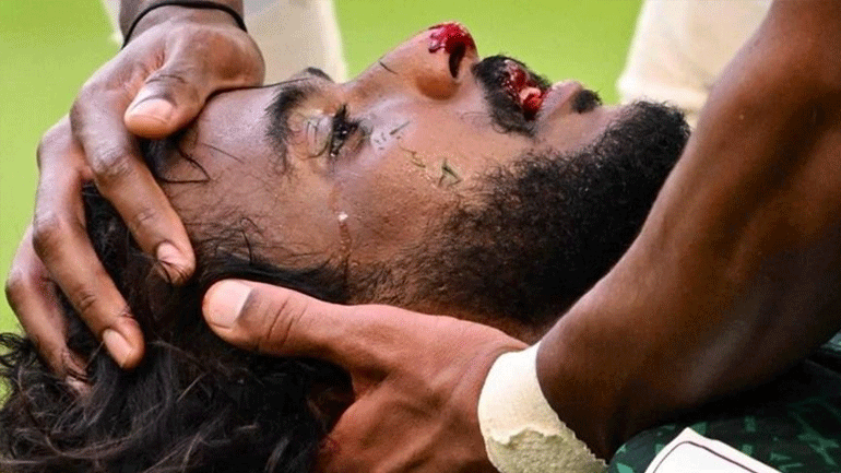 Σαουδική Αραβία: Κάταγμα γνάθου και οστών υπέστη ο Αλ Σαχράνι