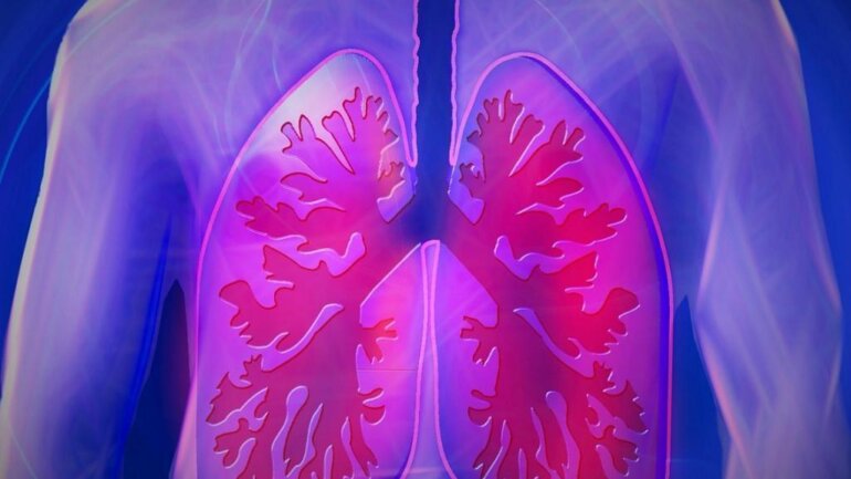 Κυστική Ίνωση: Το νέο πρόσωπο της νόσου που μετατρέπεται σταδιακά σε χρόνια διαχειρίσιμη πάθηση 