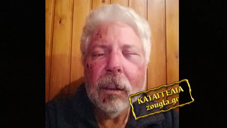 Αρκαδία: Toν ξυλοκόπησαν εργολάβοι επειδή τους κατήγγειλε για παράνομα έργα