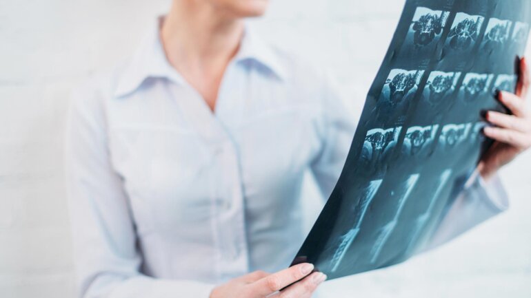 Νέα ακτινολογική τεχνική για ογκολογική θεραπεία ακριβείας