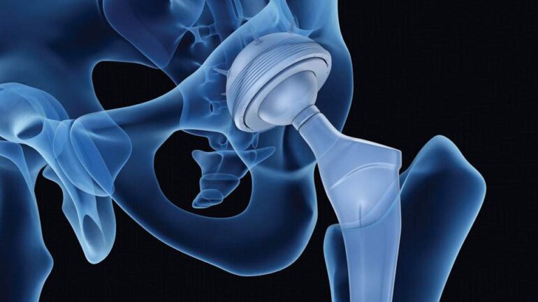 Ημερήσιας Νοσηλείας Ρομποτική Αρθροπλαστική Ισχίου και Γόνατος