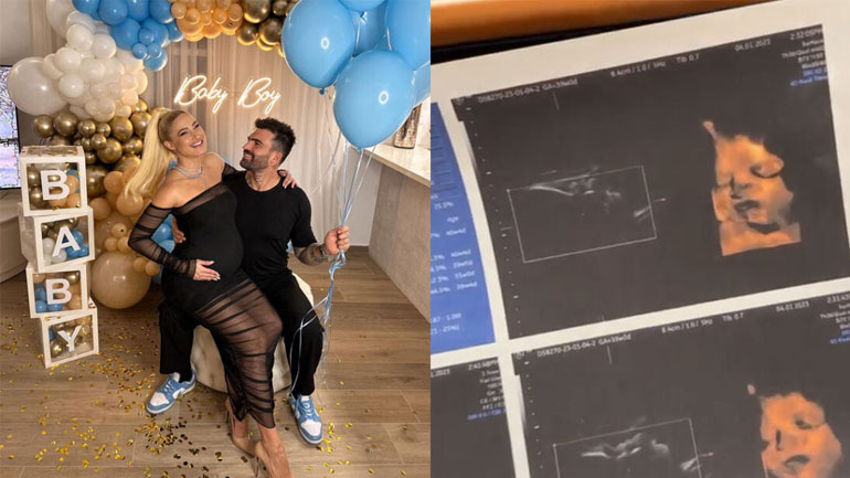 Δημήτρης Αλεξάνδρου: «Έπαθα σοκ όταν είδα το υπερηχογράφημα του μωρού μου»